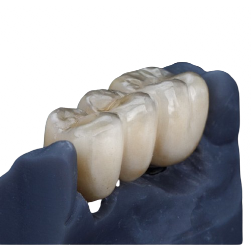 Premium Teeth for Partial Dentures
