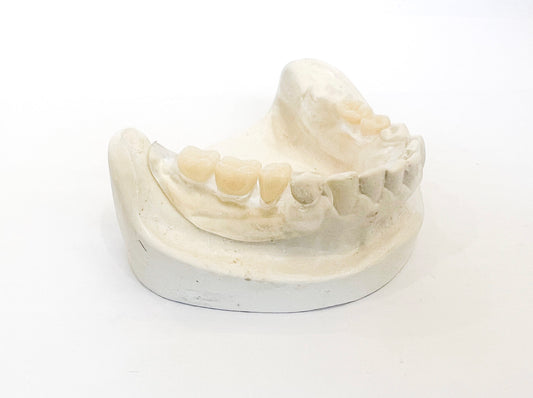 Dentadura parcial transparente Flexite