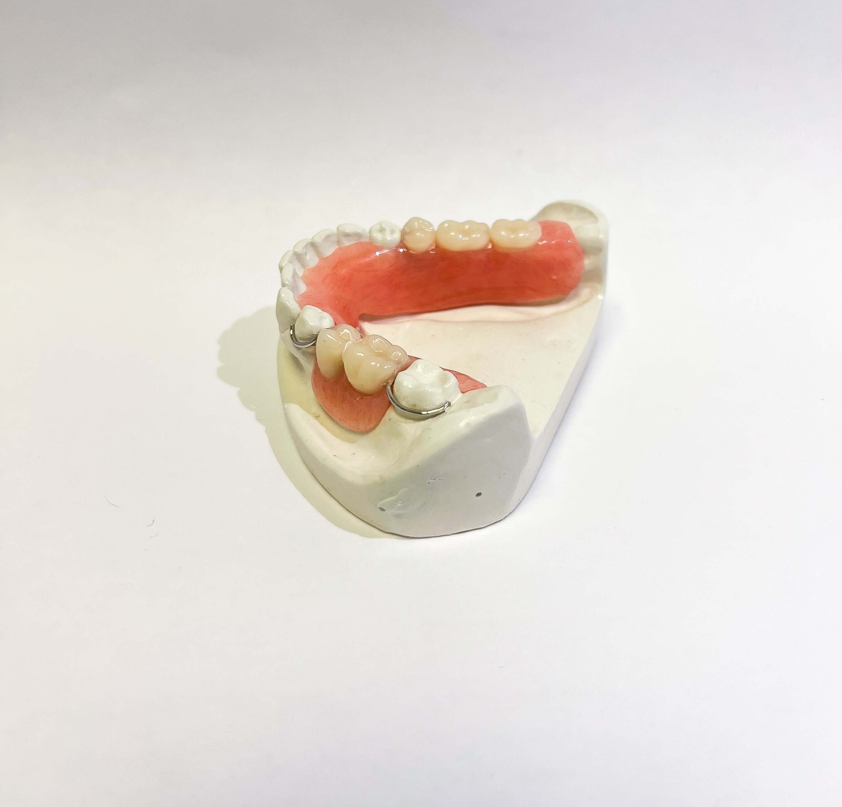 Affordable Acrylic Partial Denture Flipper Revived Smiles