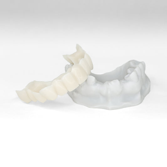 Revived Veneers