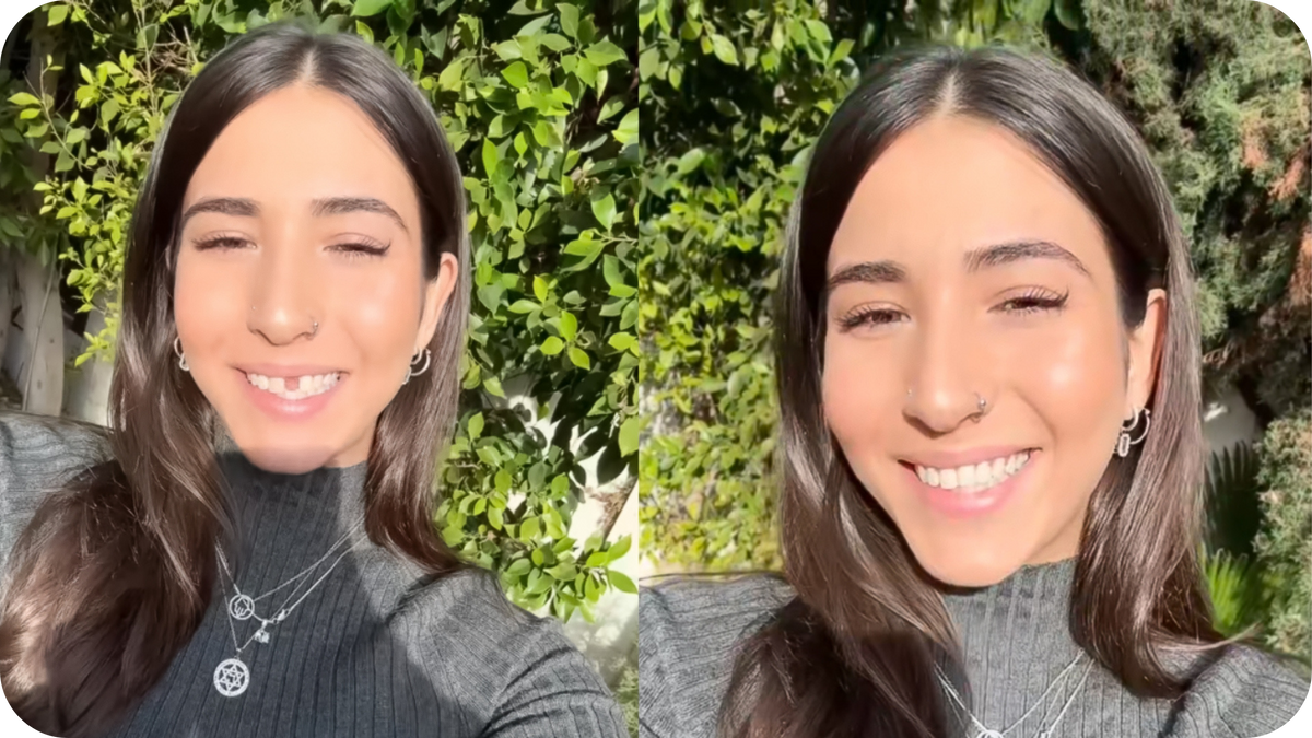 How easy is it to replace teeth with Revived Smiles?