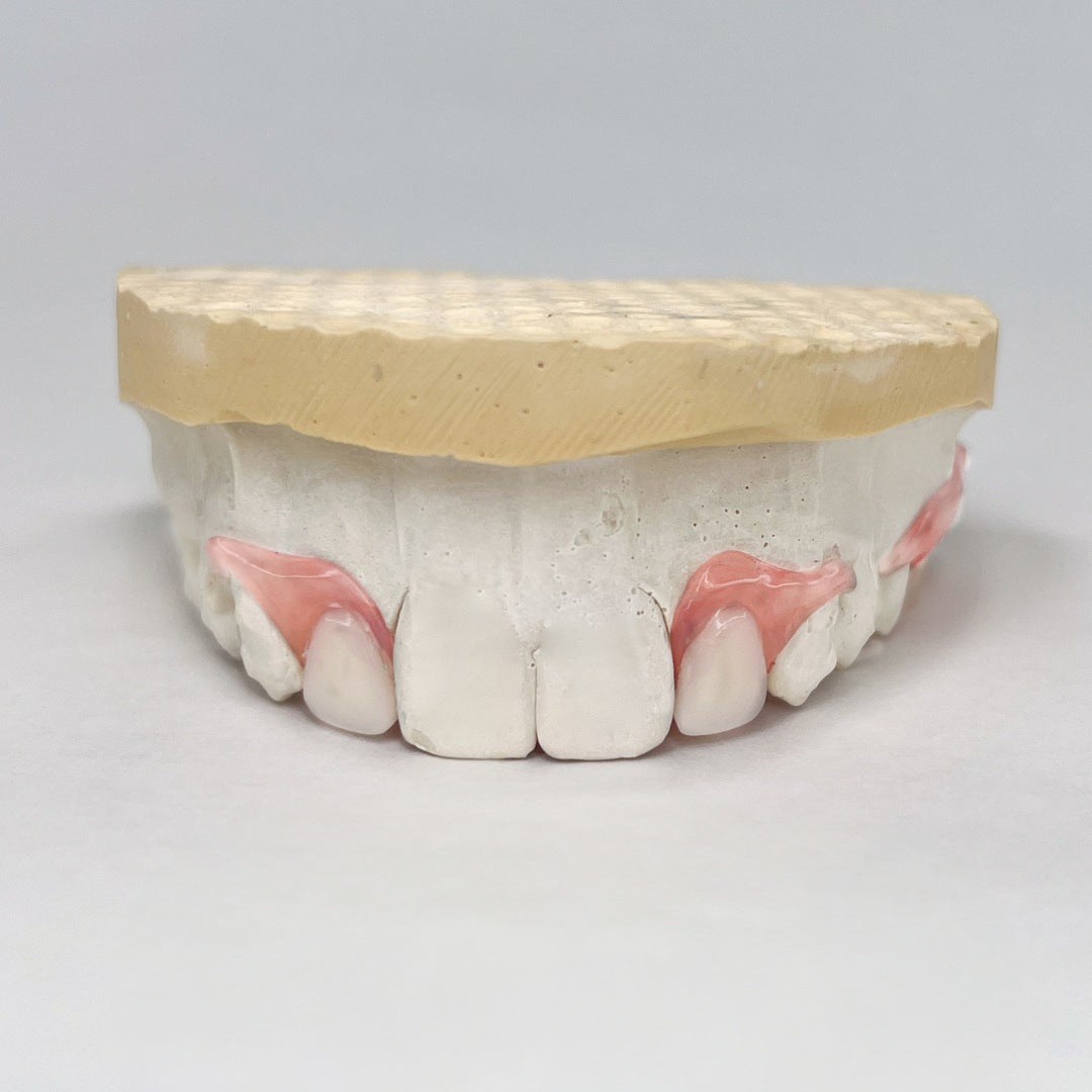 Flexible Partial Denture